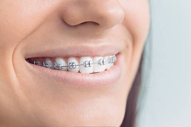 Dental Inlays and Onlays in North Vernon, IN